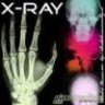 X-ray